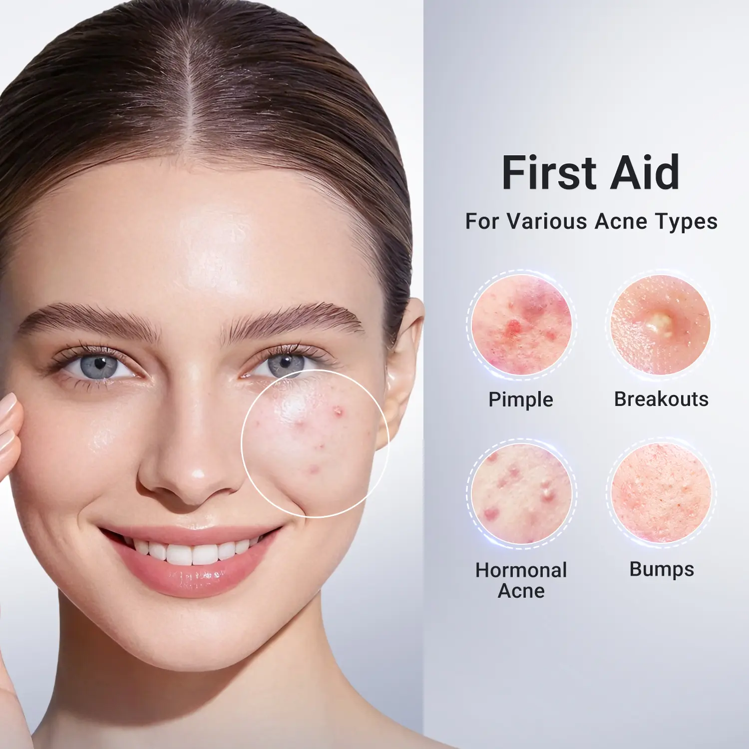 Dr.Leo Drying Lotion | Salicylic Acid & Niacinamide Blemish Spot Treatment for Acne-Prone Skin
